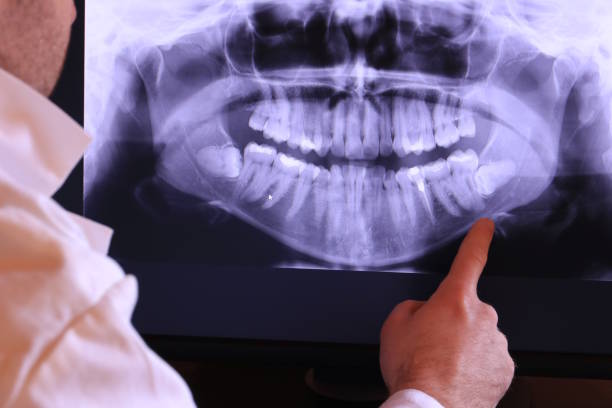 Best Broken or Cracked Tooth Emergency Dentist in Mount Carroll, IL