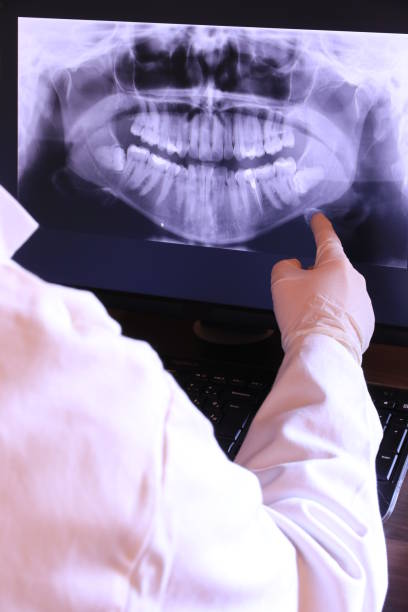 Best Emergency Dental Care for Abscessed Tooth in Mount Carroll, IL