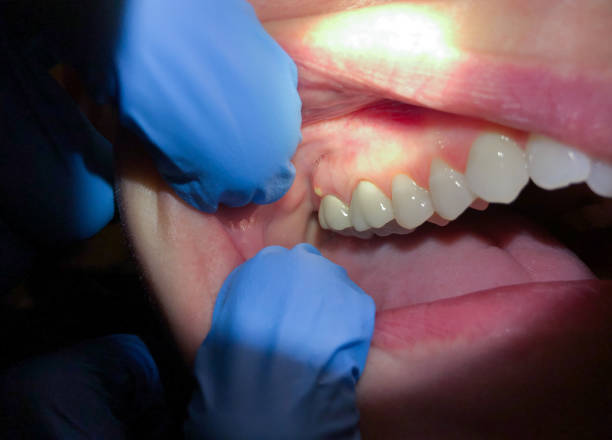 Best Urgent Dental Care for Toothache in Mount Carroll, IL