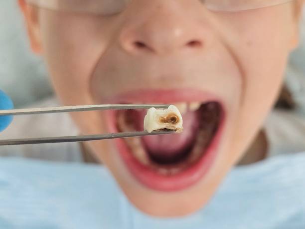 Best Emergency Dentist for Special Needs Patients in Mount Carroll, IL