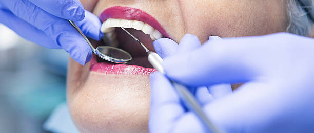 Best Emergency Dental Care for Abscessed Tooth in Mount Carroll, IL