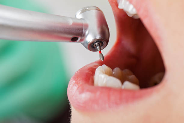 Best Mobile Emergency Dentist in Mount Carroll, IL